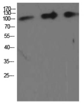Вестерн-блоттинг: лизаты клеток COLO, 293T и HeLa (слева направо), окрашенные антителами anti-Amyloid Precursor Protein antibody.