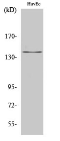 Вестерн-блоттинг: лизаты клеток HUVEC, окрашенные антителами anti-Amyloid Precursor Protein antibody.