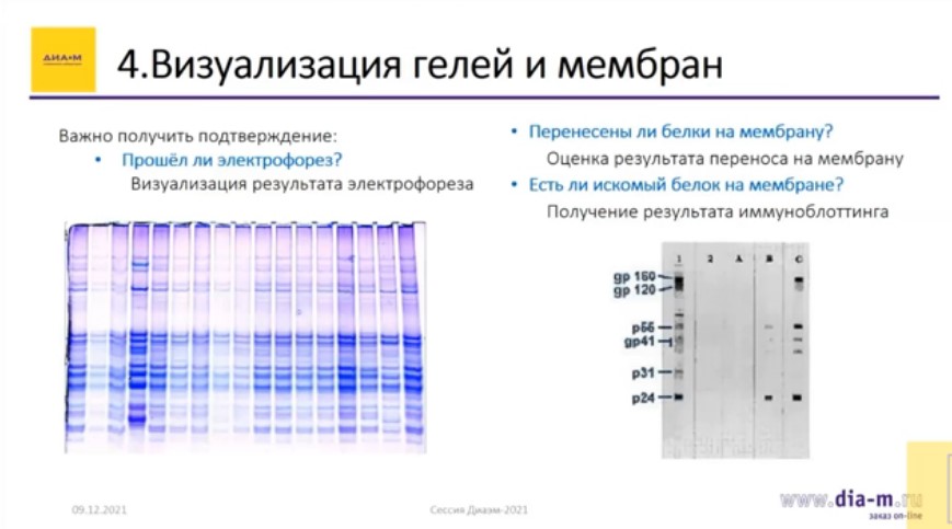 Визуализация гелей и мембран