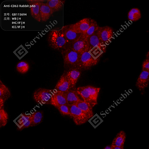 Антитела Anti-CD63 Rabbit pAb, кроличьи рекомбинантные, Servicebio