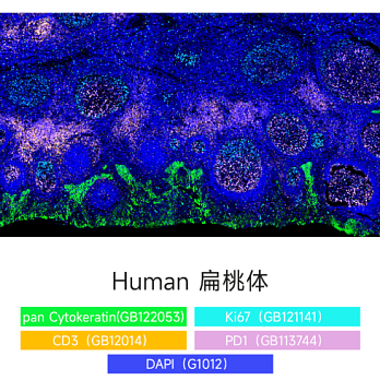 Набор для многоцветного флуоресцентного окрашивания с 4 метками и 5 цветами TSAPLus, Servicebio, Китай