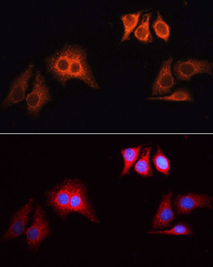Антитела Anti-Rabbit IgG (H+L) козьи, поликлональные, коньюгированые с Rhodamine (TRITC), иммунофлуоресцентный анализ