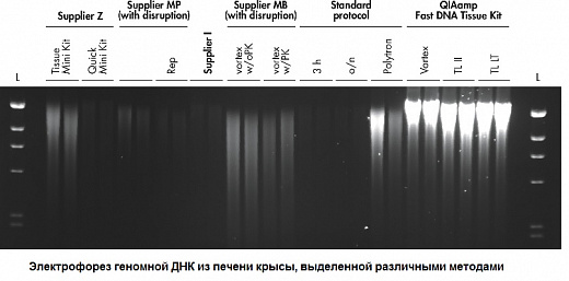 Набор для выделения ДНК из тканей QIAamp Fast DNA Tissue Kit Фото 2