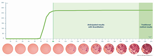 Станция автоматического инкубирования, размер колоний от 0,05 мм, со встроенным инкубатором, в режиме реального времени, ScanStation 100 Фото 3