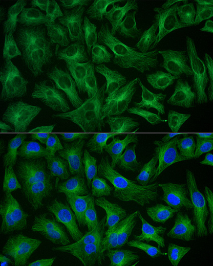 Антитела Anti-Rabbit IgG (H+L) козьи, поликлональные, коньюгированые с ABflo 488, иммунофлуоресцентный анализ HeLa клеток